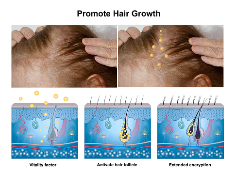 Hair growth phase, anatomy diagram of human hair. AD for essential oil or serum for hair growth
