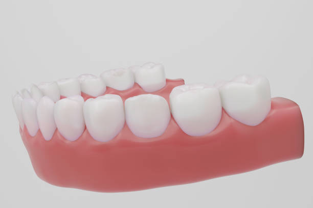 istock full teeth with healthy pink gums white background 2095501486