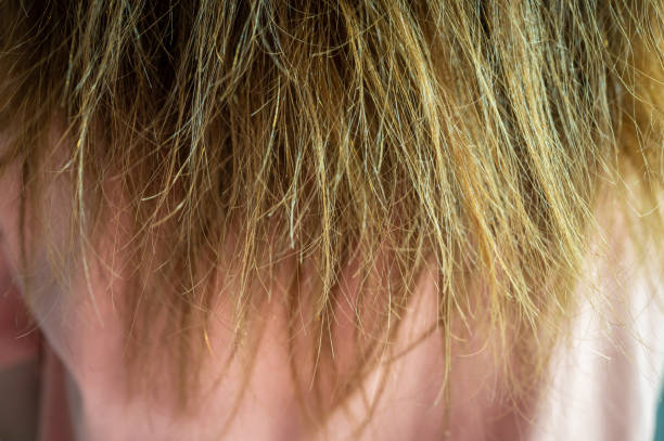 Close up of women's damaged split ended hair.