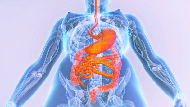 Intestine, Bowel Cancer, Digestive System, Appendix, Illness