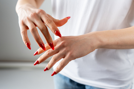 Woman scratches the top of her hand with her fingernail