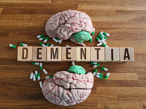 A wooden block with the word dementia engraved on it is placed next to two brain models, illustrating a connection between the condition and brain function.