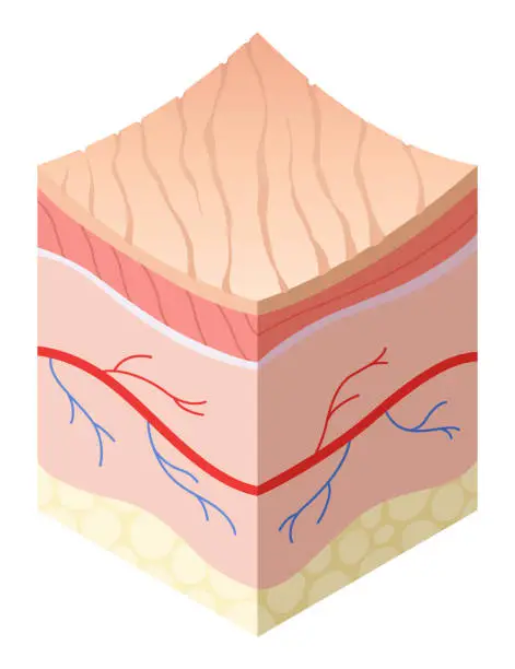 Vector illustration of Skincare medical concept. Problems in cross-section of human skin horizontal layers structure. Anatomy illustrative model unhealthy layer of skin