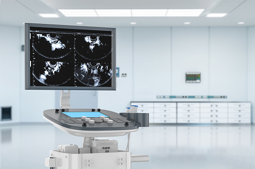 3d rendering ultrasound machine in hospital room