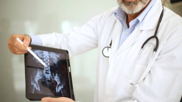 istock unrecognizable doctor reviewing spinal X-ray on a tablet for diagnostic use. 2098493080
