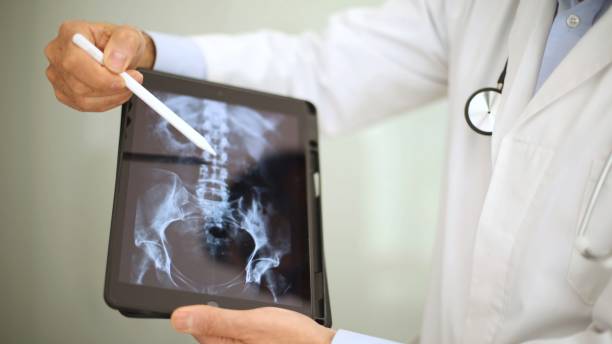 istock Doctor analyzing spine X-ray on tablet, highlighting diagnostic radiology. 2098493084