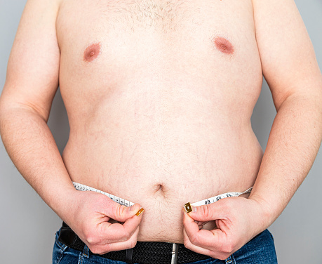 Close-up of the overweight belly of an unrecognizable Caucasian man with a tape measure that is not enough to encircle his abdomen.