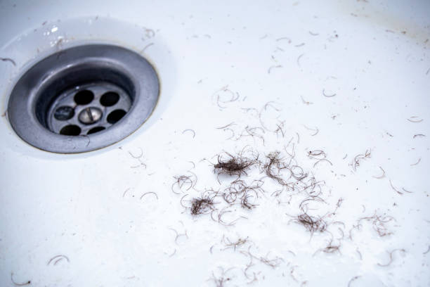 shaved hair from the intimate areas of the pubic area after shaving and depilation remaining on the walls of the bathroom sink, close-up texture - metal rusty rust steel imagens e fotografias de stock