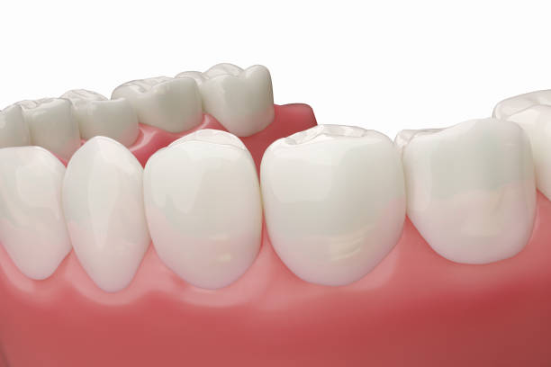 istock lower teeth with healthy pink gums 2105829353