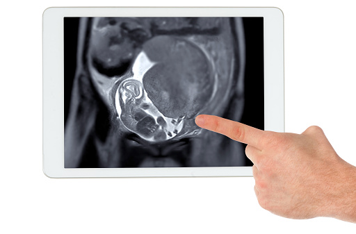 MRI during pregnancy ensures non-invasive evaluation of fetal health on tablet, maternal safety, obstetric care, and diagnostic precision, offering detailed imaging of fetal anatomy .Clipping path.