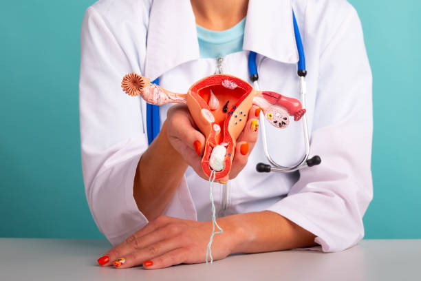 woman gynecologist demonstrating female reproductive system model and hygienic tampon. women healthcare and female hygiene concept. - menstruation tampon gynecological examination sex imagens e fotografias de stock