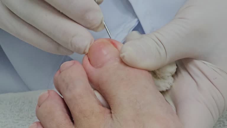 Treatment with a podiatrist