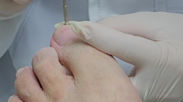 Treatment with a podiatrist