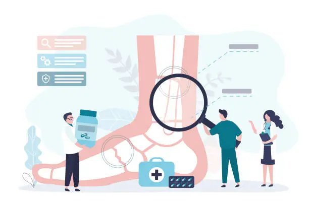 Vector illustration of Giant human leg with trauma. Broken leg, traumatologist appointment. Group of traumatologists researching, diagnosis and help. Treatment, health care.