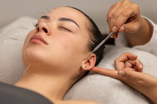 A young woman getting an acupuncture treatment on her head, ear and neck. She is lying in the therapist's office, the therapist is using tool for point pressure on her ear.