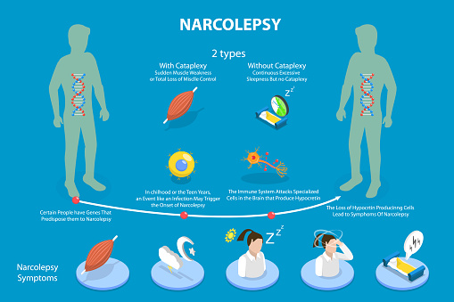 3D Isometric Flat Vector Conceptual Illustration of Narcolepsy, Educational Schema