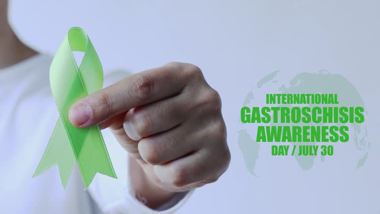 International Gastroschisis Awareness Day July 30