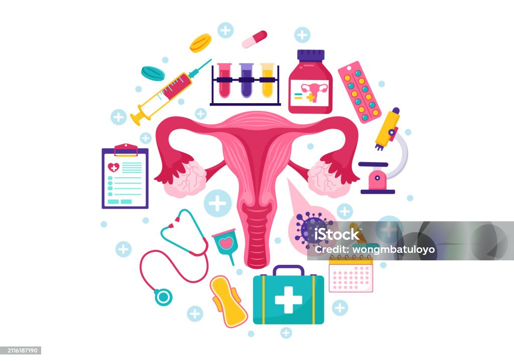Endometrit Endometriosis Vector Illustration With Condition The Endometrium Grows ...