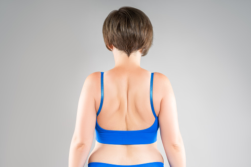 Female back, woman in blue bra on gray studio background, body care and correction of scoliosis concept