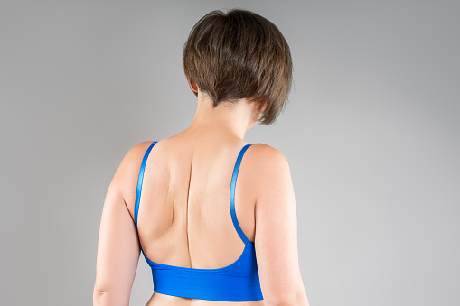 Female back, woman in blue bra on gray studio background, body care and correction of scoliosis concept