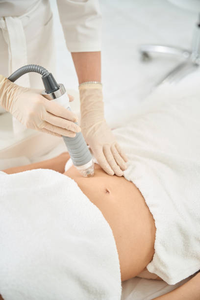 istock Cosmetologist carrying microneedle and radio frequency therapy on client abdomen 2118051868