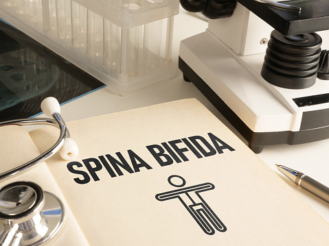 Spina bifida is shown using a text