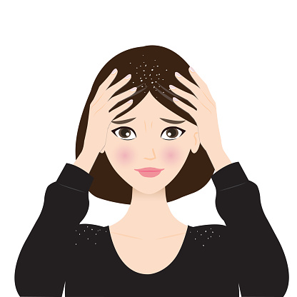 The woman is worried about dandruff on her scalp vector illustration isolated on white background. Dandruff is small, round, white dry flakes in hair and on shoulder. Hair care and problem concept.