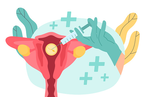 Artificial insemination concept. Hand in protective gloves with syringe with sperm. Anatomy and biology. Female reproductive system and fertility. Cartoon flat vector illustration