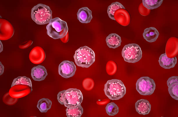istock Acute Lymphocytic Leukemia (ALL) - isometric view 3d illustration 2121761207