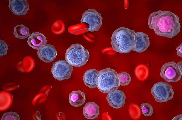 Acute myeloid leukaemia (AML) - isometric view 3d illustration stock photo