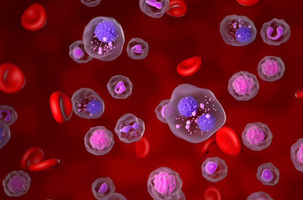 Multiple myeloma (MM) - isometric view 3d illustration stock photo