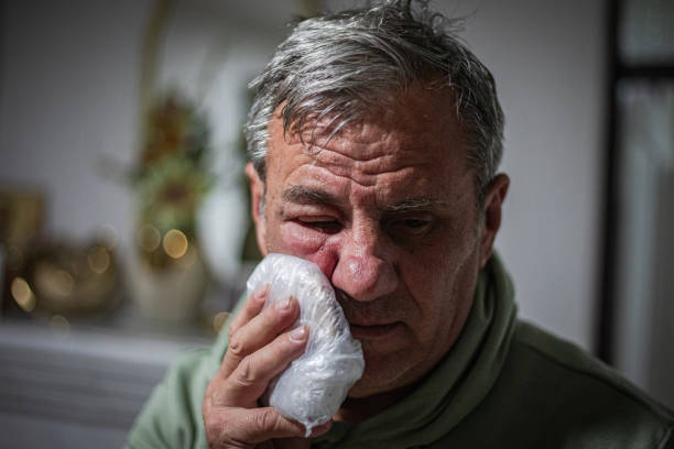 istock Red swollen eyelid on male face, insect bite allergy 2121872355