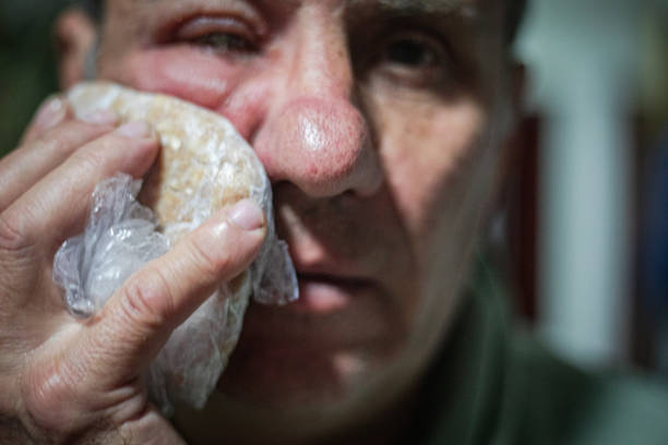 Red swollen eyelid on male face, insect bite allergy