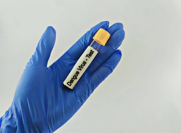 istock Blood samples isolated on white background for dengue virus test. 2122656049