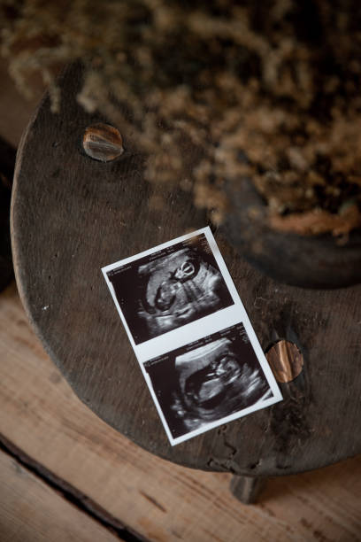 istock Ultrasound scan baby on wooden table 2123185810