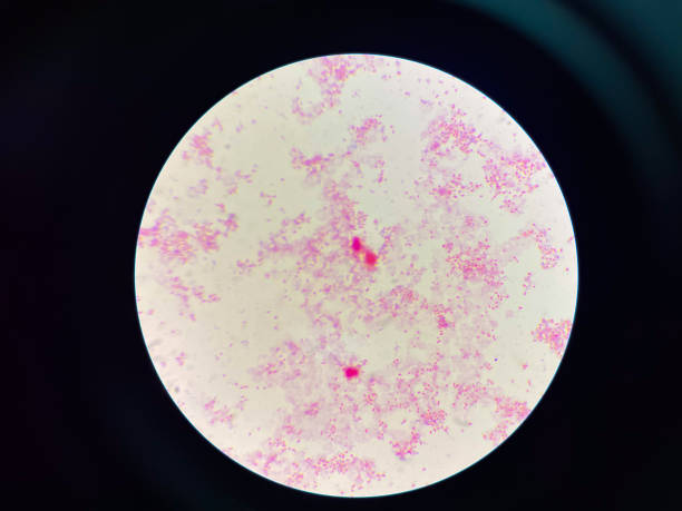 istock Gram negative bacilli in chemo culture. 2124897538