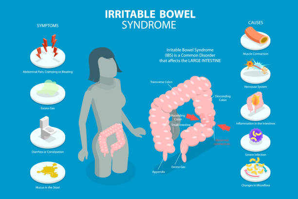 3d isometric flat vector conceptual illustration of irritable bowel syndrome - reizdarmsyndrom stock-grafiken, -clipart, -cartoons und -symbole