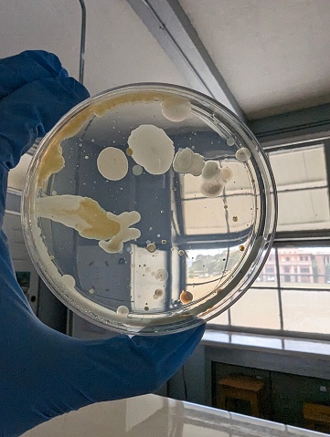 Bacterial colonies on a plate count agar plate in a Microbiology laboratory for lab. The bacteria colonies came from a raw vegetable sample