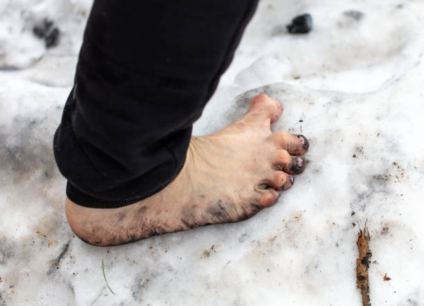 Bare legs of a man in the snow in winter.