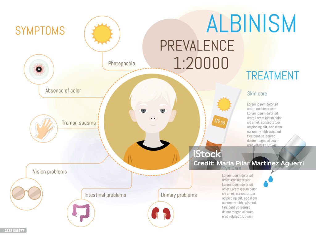 Albinism Explained Image Infographic About Albinism Stock Illustration - Download Image Now ...