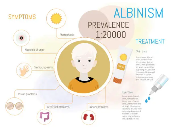 Vector illustration of Infographic about albinism