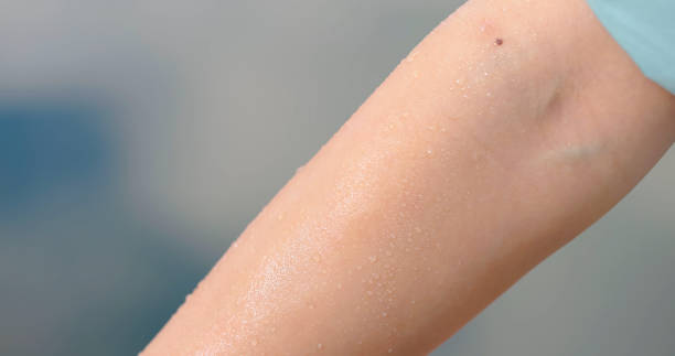Closeup asian human arm with sweat due to hot high temperature