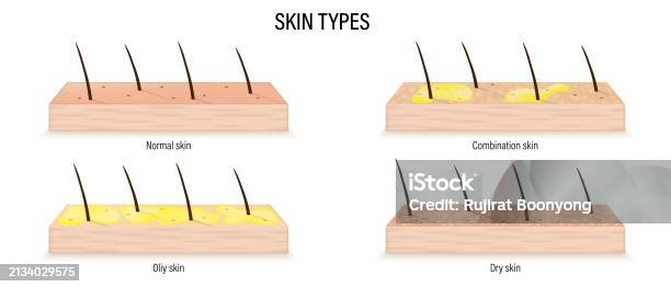 Five Basic Skin Types Skin Types Vector Different Types Of Skin Problems Normal Combination ...