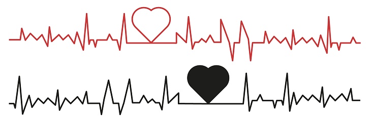 Palpitation. Cardiogram design elements set. Cardiograms of a healthy heart and a bad heart. EPS 10.