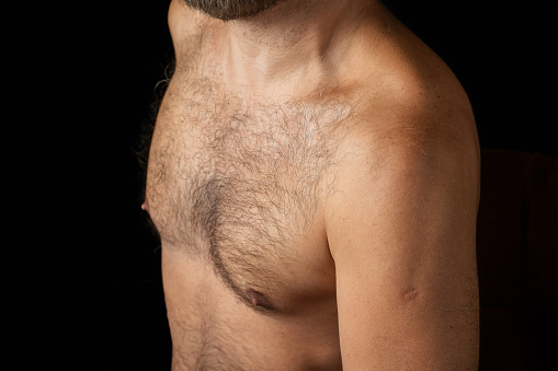 Aging Gracefully: Man's Midlife Chest Hair
