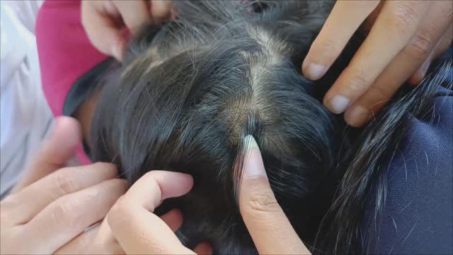 Hair and scalp health