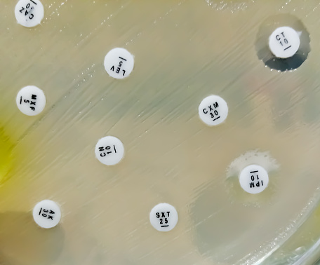 Antimicrobial susceptibility testing in petri dish. Showing all Antibiotic is resistance here.
