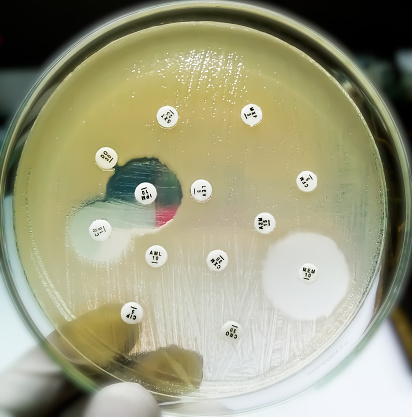 Antimicrobial susceptibility testing in petri dish. Microbiologist check Antibiotic resistance of bacteria