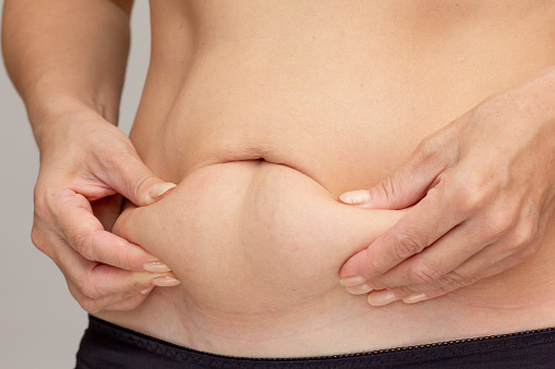 Hands on belly pressed skin to show sagging skin after diet and stretch marks after pregnancy over gray background