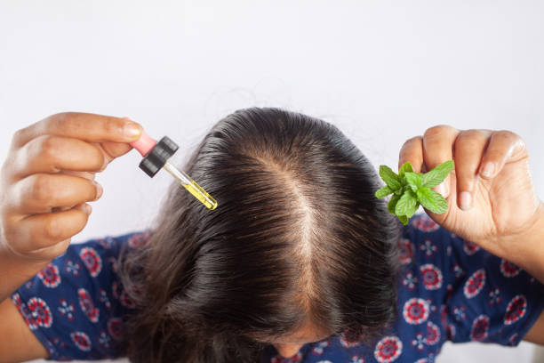 istock female using Peppermint herb essential oil for the treatment of female pattern baldness or alopecia 2138564494